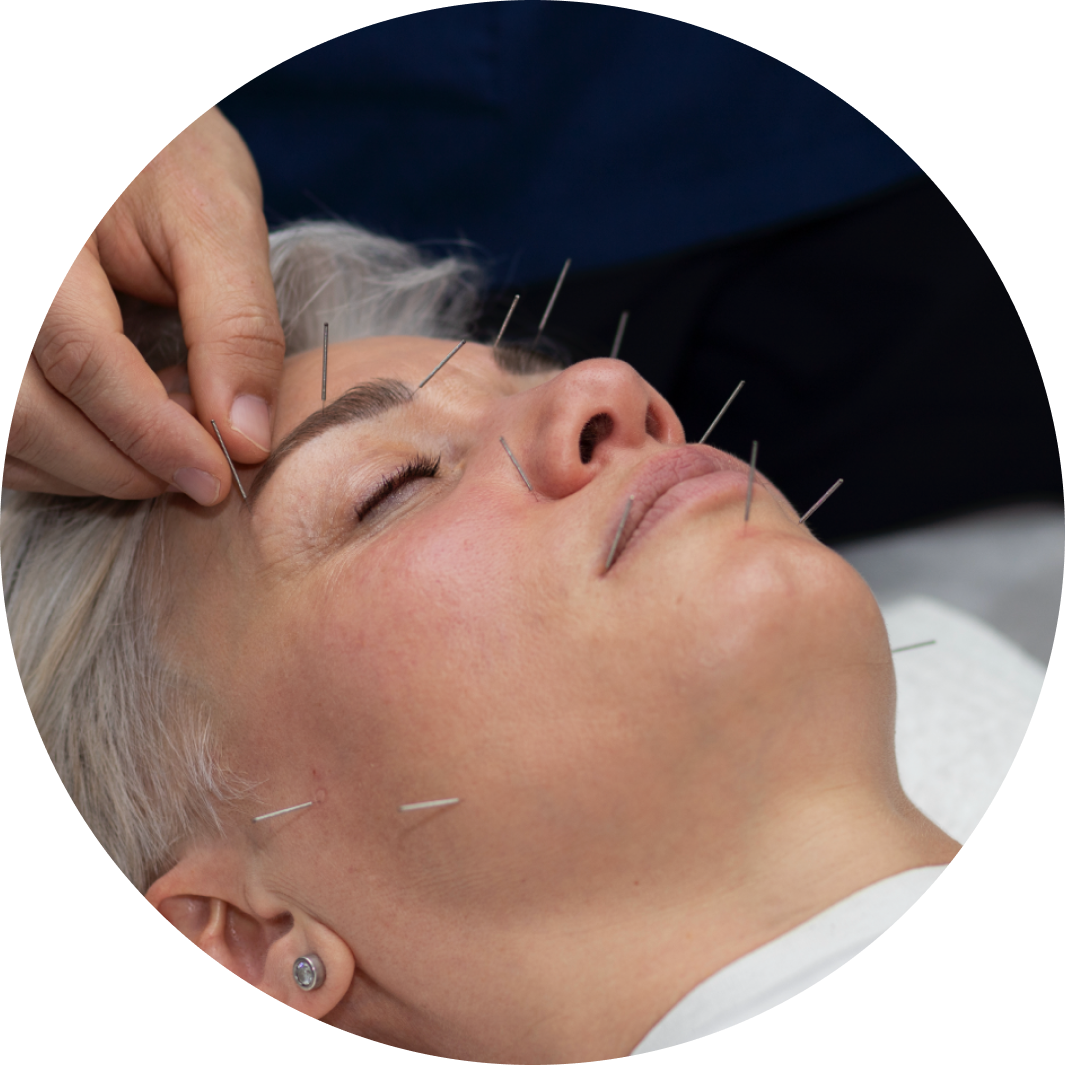 Aculifting